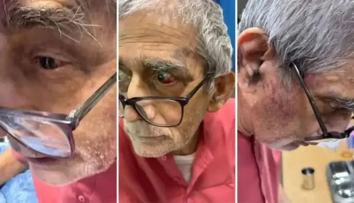 पद्मश्री डॉ. टीके लाहिड़ी मारपीट मामला: BHU में एक हफ्ते बाद भी FIR न होने से उबाल